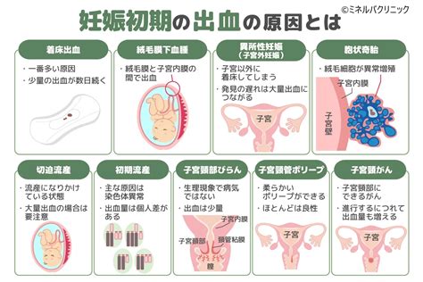 胎盤形成出血|妊娠中の出血の原因は？初期～後期まで 